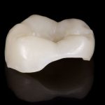 caries restoration 4