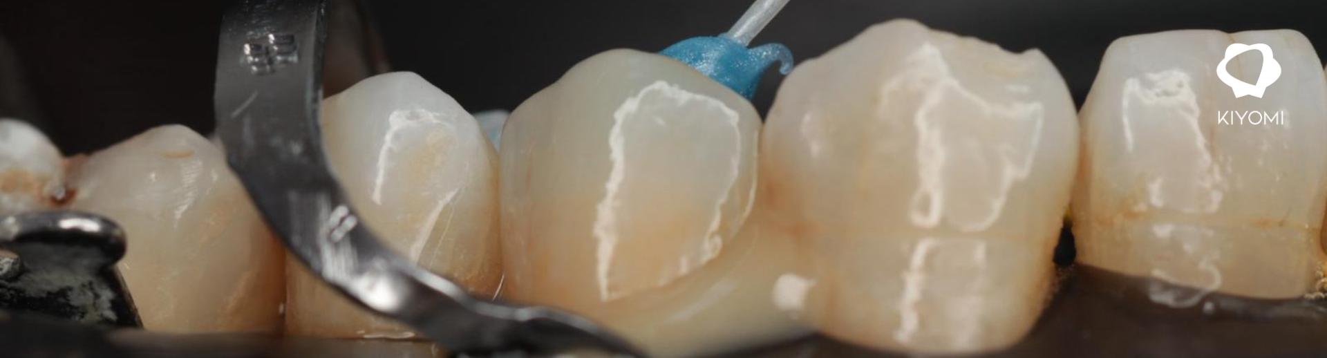 1920x518-260225-BLOG-KIYOMI-CASO-CLINICO-VICTOR-GARCIAS